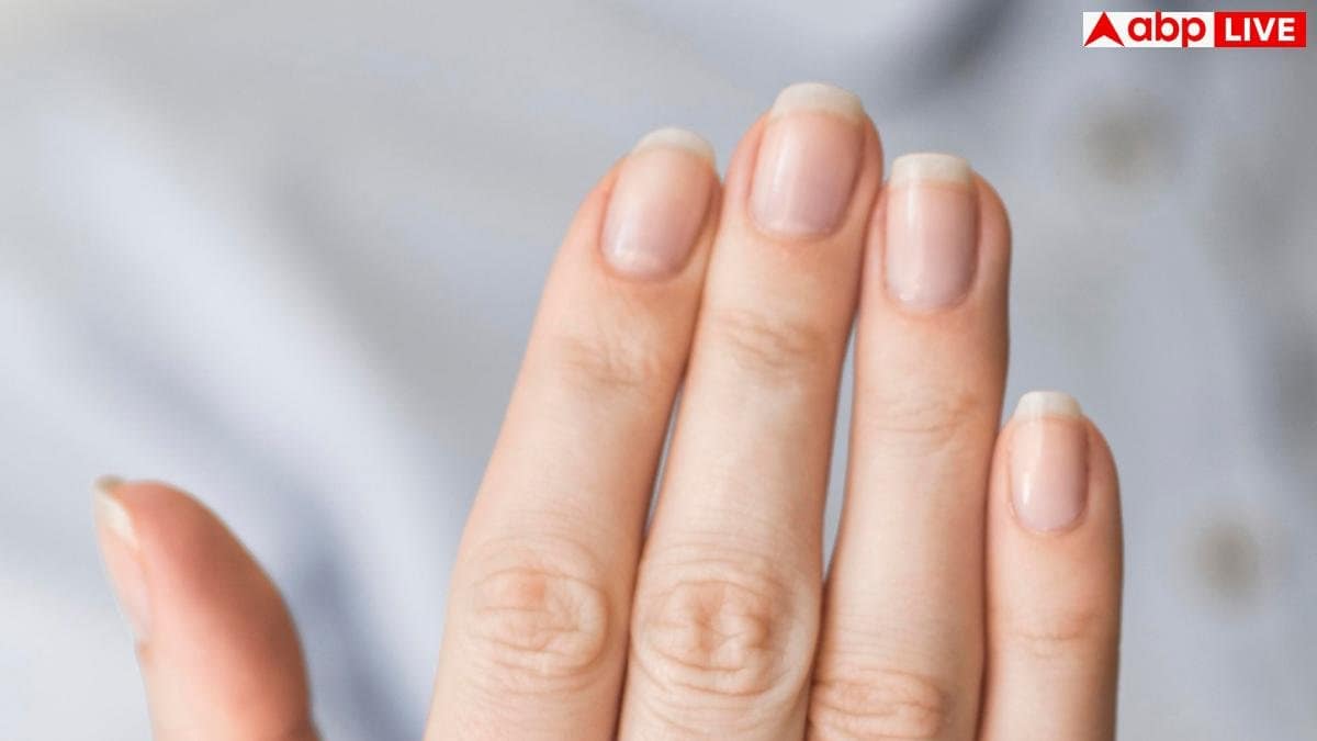 White Marks On Nails: आपके नाखूनों पर बन गया है व्हाइट निशान, जानें किस बीमारी का है संकेत