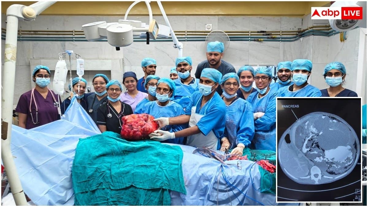 सफदरजंग के डॉक्टरों ने किया चमत्कार, 19 साल की लड़की के पेट से निकाला 10 किलो का ट्यूमर